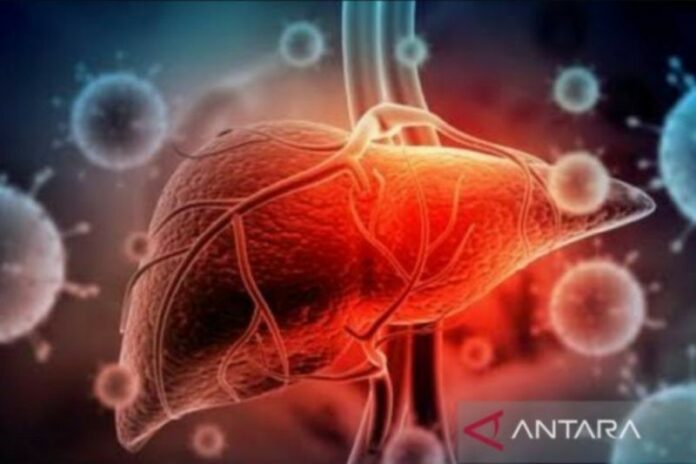 hepatitis